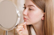 © st.kolesnikov - Girl uses transparent acne patch on chin and cheeks while checking skin in mirror.