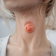 © Stacy - Swollen lymph nodes in woman's neck