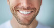 © red_orange_stock - Zoomed-in image of a smiling man showing bright white teeth and well-groomed beard, conveying happiness and health.