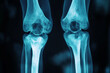 © Wizard - Human Knees XRay Scan Detailed View Blue Hues,