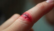 © Polina - Close-up of cut finger with fresh wound and red blood