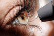 © Vladislav - A device for measuring intraocular pressure. Close-up of the eye during diagnosis. The concept of ophthalmologic diagnosis and treatment.