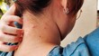 © Rung Kh - Portrait the fingers scratching the rash hives allergy and inflammation skin, reaction and urticaria, scar and atopic on the neck of the woman, health care and medical concept.