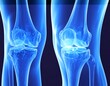 © Sungging - 3D anatomical knee joint view