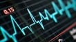 © Olena Ryzhenko - A realistic heart rate monitor screen showing vital signs, sharp close up of the ECG wave on black background