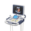 © Png guru - A detailed ultrasound machine displaying a baby scan, isolated on transparent background