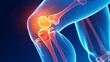 © SS Digital - 3D illustration of a human knee joint with a highlighted pain area, depicting orthopedic and joint pain concepts in healthcare