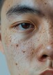 © Rawpixel.com - Minimal photo close up on face pores texture cheek skin forehead.