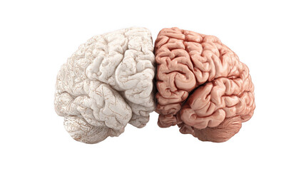 Poster - two halves of human brain are shown side by side, one white and one pink, representing the left and 