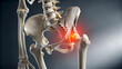 © Drago Designer - Human hip bone skeleton anatomy with highlighted joint pain and inflammation