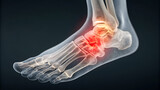 Human foot skeleton with ankle joint inflammation highlighted in red and yellow