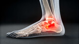 Human foot skeleton with ankle joint highlighted in red showing pain and inflammation