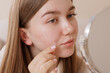 © st.kolesnikov - Young woman applies a hydrocolloid acne patch to her cheek, showing modern skincare, blemish treatment, and selfcare routine for clear, healthy skin.