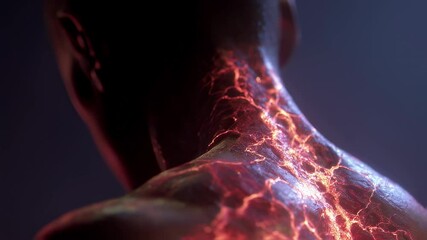 Poster - Medical visualization displaying glowing capillaries affected by dengue virus on a patient's back, highlighting the vascular impact of the disease