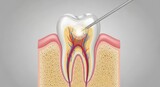 Dental anatomy illustration root canal treatment procedure