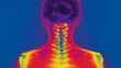 © suyu - Medical thermal infrared scan of female back showing full spine and upper body with temperature gradient from blue cold to red hot, potential joint inflammation visualized by color heat map