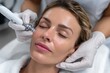 © YouraPechkin - Microneedling treatment for rejuvenation in a skincare clinic setting