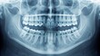 © Владимир Platon - A detailed panoramic dental X-ray revealing a full set of healthy adult teeth and jaw structures. This medical imaging showcases the intricate bone and tooth anatomy