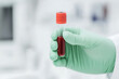 © A2Z AI  - Gloved hand holds blood sample tube. Medical research, diagnostics and analysis of biological fluid in clinic lab. Healthcare. Close up.