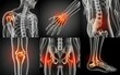 © Risat Designer - Human anatomy x ray collage showing painful joints and skeletal system