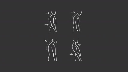 Poster - Unhealthy posture animation set. Backbone illnesses animated white line icons. Lumbar lordosis, kyphosis. Chiropractic, orthopedic. Isolated elements on dark background. Alpha channel HD video