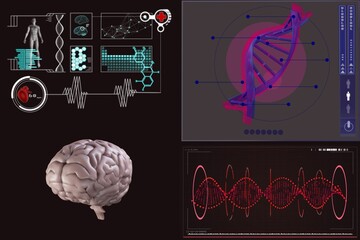 Poster - Human brain with various medical reports