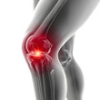 © Yasir - Anatomical rendering showcases a knee joint with highlighted inflammation, emphasizing medical or healthcare applications, transparent background