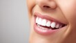 © LU - A close-up of bright white teeth with a natural smile, highlighting dental hygiene.