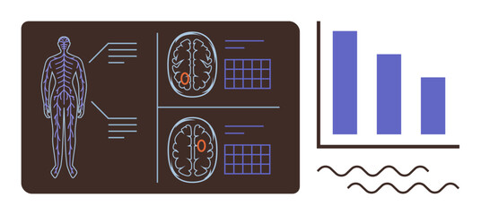 Poster - Human anatomy diagram supplemented by brain scan imagery alongside bar chart analysis. Ideal for healthcare, neurology, science, diagnostics, medical research, data analysis, and education themes. A