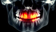 © net4up - Digital X-Ray of Human Jaw Highlighting Severe Tooth Pain and Inflammation