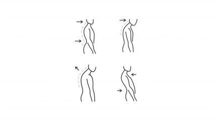 Poster - Unhealthy posture line animation set. Backbone illnesses animated icons. Lumbar lordosis, kyphosis. Chiropractic, orthopedic. Outline elements on white background. HD video with alpha channel