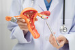 © Warawan - Uterus, doctor holding human anatomy model for study diagnosis and treatment in hospital.