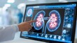 © Kannika - Kidney stone risk. Medical professional analyzing kidney scans on a digital display in a clinical setting.