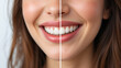 © Annette - woman teeth before and after whitening. Over white background. Dental clinic patient. Image symbolizes oral care dentistry, stomatology