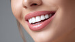 © Zander - Close-up of a Beautiful Healthy Smile with White Teeth