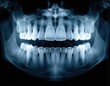 © Pete - Close-up dental X-ray showing human teeth, jaw anatomy. Medical imaging reveals tooth structure, roots, bone in detail. Useful for dental education, diagnostics, oral health awareness campaigns.