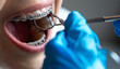 © M-Production - Close up of orthodontist checking braces with dental mirror and tool.