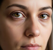 © JPhotography - Visage d'une femme fatiguée avec des poches sous les yeux