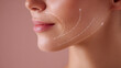 © koranis - Close-up stylized thread lifting sagging cheek skin