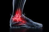 Foot anatomy with highlighted pain in the ankle area, showing potential sprain in sports activity