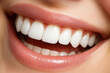 © sunny - Professional Teeth Whitening Treatment For A Radiant Smile