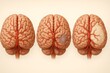 © Maryia - Comparative 3D render of three brains: normal brain with clear arteries, second with blocked artery and small ischemic zone, third with large pale infarction, stroke pathology illustration.
