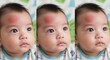 © all is well - A closeup of a babys face shows a bruise on the forehead, highlighting the vulnerability and delicate nature of childhood