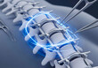 © Khorshed - Spinal fusion surgery concept. Futuristic 3D render of vertebrae with medical screws and rods for spine stabilization.