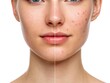 © Alamin - Close up of a woman s face showing a comparison of skin before and after treatment