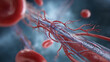 © suldev - Peripheral Artery Angioplasty as Stent surgery procedure used to open narrowed or blocked arteries outside the heart as in the legs representing cardiology and blood circulation disease treatment.