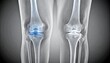 © Theerapat - 3D rendering of human knee joint X-ray, showcasing bones and a highlighted area, symbolizing medical imaging, orthopedic health, or pain.