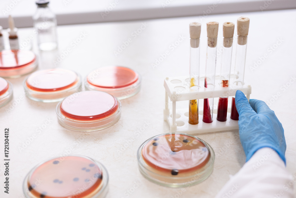 Laboritory Image Pathogen Microbiology hand medical working on agar plate culture bacteria and ...