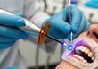 © IbragimovN - Dental procedure with polymerization lamp and tools in modern clinic close-up