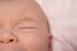 © Yekatseryna - Baby eyes with eye mucus in selective focus. Disease tear ducts tons of newborns close up. Nasolacrimal duct obstruction in baby it is a blockage of the lacrimal drainage system.